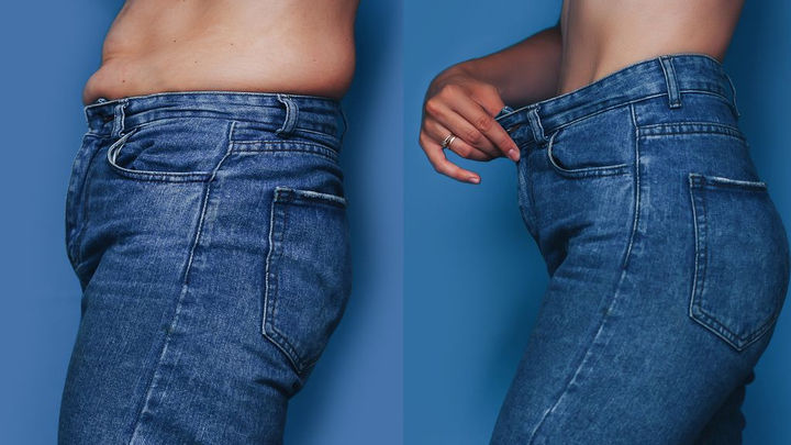 Phẫu thuật ‘nắn’ xương sườn giúp cô gái gen Z có vòng eo con kiến, giảm 15cm