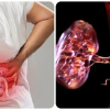 19 dấu hiệu thận yếu bạn không nên bỏ qua