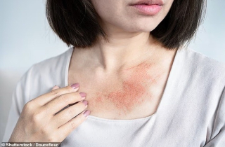 Chuyên gia chỉ ra sai lầm nguy hiểm khi sử dụng nước hoa