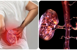 19 dấu hiệu thận yếu bạn không nên bỏ qua