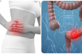 8 dấu hiệu ung thư đại tràng tuyệt đối không nên bỏ qua