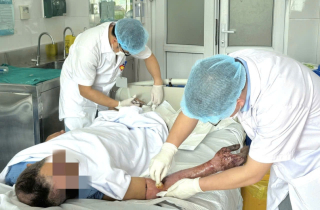 Không chạm vào điện, vẫn bị bỏng nặng do tia hồ quang