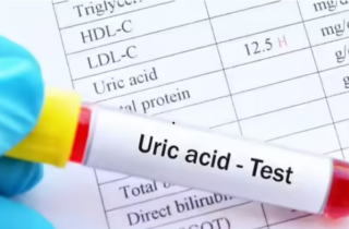 5 thực phẩm giúp giảm nồng độ axit uric nhanh chóng