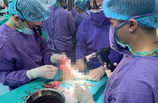 Nối lại chân đứt lìa cho nữ sinh 19 tuổi sau va chạm với mô tô phân khối lớn