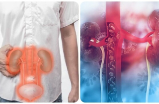 Suy thận có dấu hiệu gì?