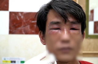 Kiến ba khoang lại tấn công người TP.HCM, bác sĩ cảnh báo chữa trị bằng 'mẹo'