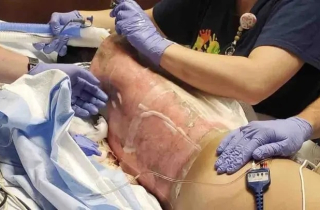 5 thử thách TikTok cực nguy hiểm, có một thử thách từng giết chết hơn 100 người