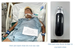 Suy thận, phổi tắc nghẽn vì hút thuốc lá điện tử từ năm 13 tuổi