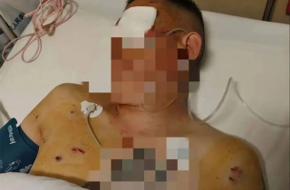 Khách rút tiền vật lộn với tên cướp 20 phút trước ngân hàng, bảo vệ bị tố mặc kệ