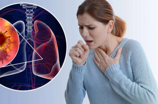 9 dấu hiệu ung thư phổi giai đoạn đầu thường bị bỏ qua