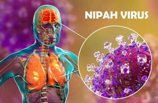Virus Nipah xuất hiện hơn 20 năm, gây tỷ lệ tử vong cao, vì sao chưa có vaccine?