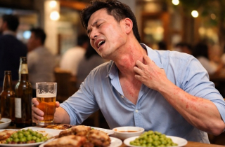 Uống vài ngụm rượu đã nổi mề đay, khó thở: Dấu hiệu dị ứng đe dọa tính mạng